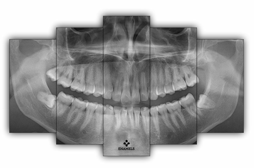 OPG Split Art